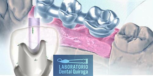 LABORATORIO DENTAL QUIROGA