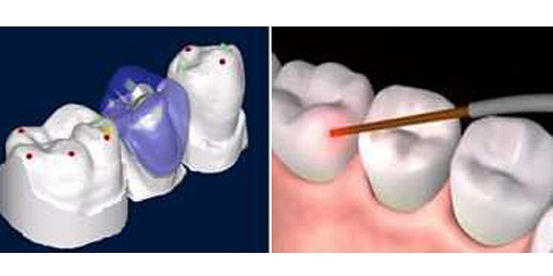 LABORATORIO DENTAL QUIROGA
