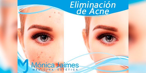 Monica Jaimes Medicina Estetica