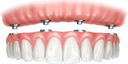 3 Dent Soluciones
