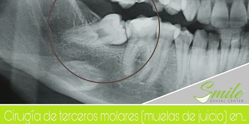 Smile Dental Center