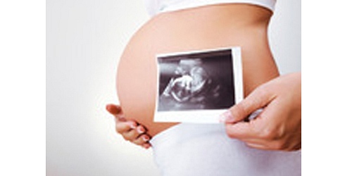 Dra. Julia Lozano Santillán - Obstetra