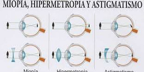 OPTICA IVIS VISION