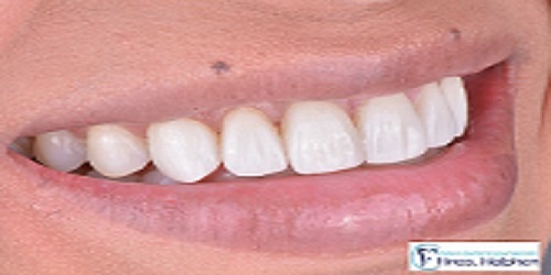 CLINICA DENTAL ESPECIALIZADA HNOS HALPHEN
