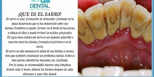 DENTAL EMPRESARIAL DR. JOSE RODOLFO BOBADILLA A.