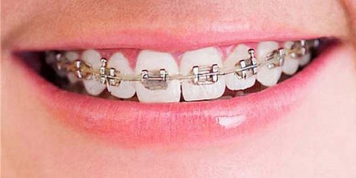 DENTAL EMPRESARIAL DR. JOSE RODOLFO BOBADILLA A.