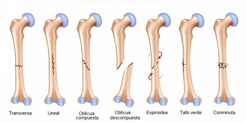 Dr. Marcelo Gómez G. Traumatología y Ortopedia