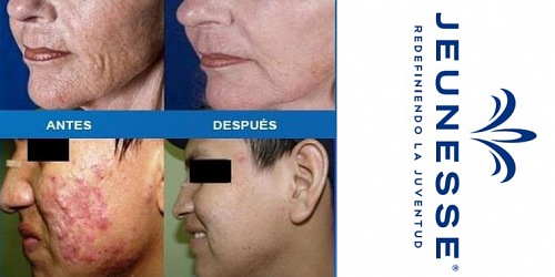Jeunesse productos de salud belleza Panama