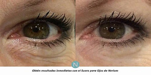 Filtros de Agua y Utensilios de cocina Villavicencio