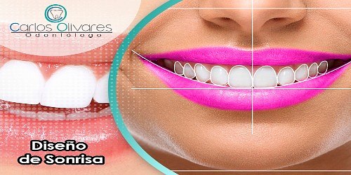 Odontologo Carlos Olivares