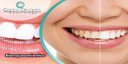 Odontologo Carlos Olivares