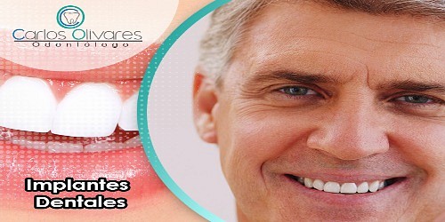 Odontologo Carlos Olivares