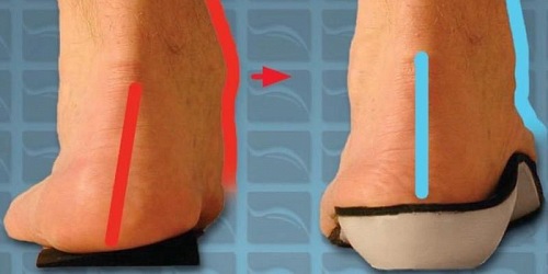 F.J. Loock Orthotic and Prosthetic Services