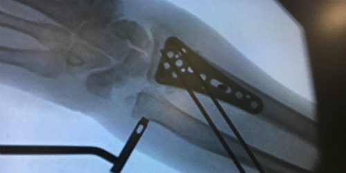 Médico Especialista en Traumatología y Ortopedia