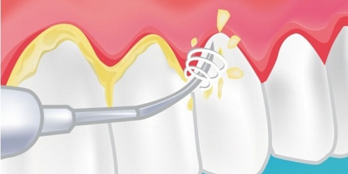 ORTODONCISTAS EN CANCÚN FAMILY DENTISTRY