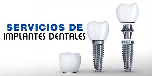Rehabilitador Oral Carlos Corzo en Cucuta