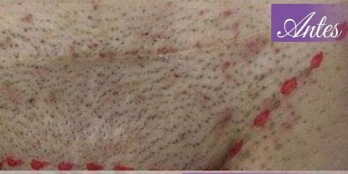 CLÍNICA DE ESTÉTICA E DEPILAÇAO A LASER LA PELLE