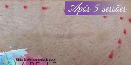 CLÍNICA DE ESTÉTICA E DEPILAÇAO A LASER LA PELLE