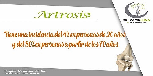 TRAUMATOLOGIA Y ARTROSCOPIA EN CANCUN DR. ZAMIR LUNA