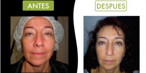 IMAGEN & SALUD
