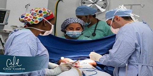 Dr. CESAR CUADROS CIRUJANO PLASTICO CALI