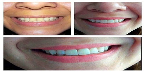 VIDADENTAL ODONTOLOGÍA INTEGRAL EN MACHALA