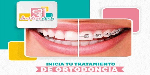 Odontologia Implantdents