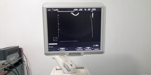 Ecofetal