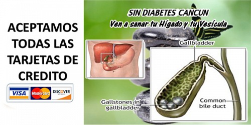 Sin Diabetes Cancun