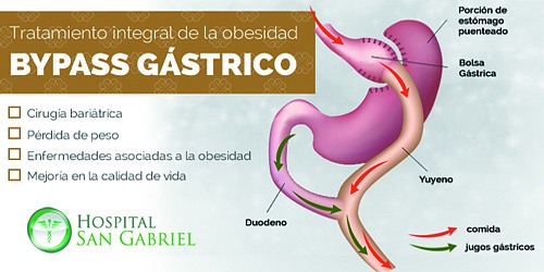 GASTROCIRUGIA Y OBESIDAD EN CANCUN DR. ROBERTO CISNEROS 