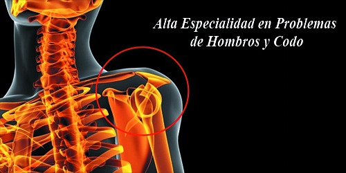 CIRUGÍA DE HOMBRO Y CODO EN CANCUN DR. JOSE SANTANA DE DIOS