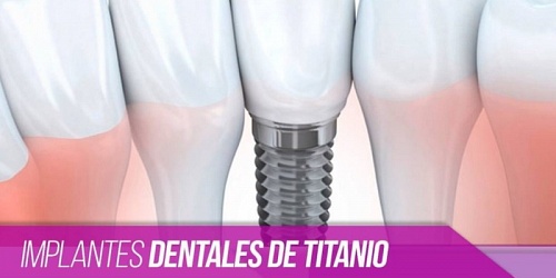 Clinicas Odontologicas En Panama BeloDent
