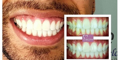 Clinicas Odontologicas En Panama BeloDent