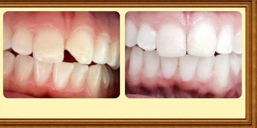 IPS PUNTO SALUD ORAL LAB