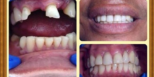 IPS PUNTO SALUD ORAL LAB