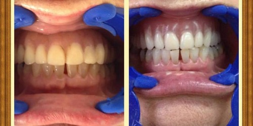 IPS PUNTO SALUD ORAL LAB