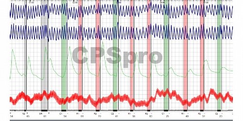 VRE Polygraph Services