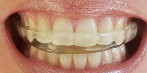 Clínica Dental RIE Talca-Chile