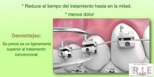 Clínica Dental RIE Talca-Chile