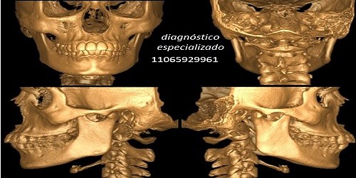 Odontología Neurofocal y Ortopedia Maxilar ATM