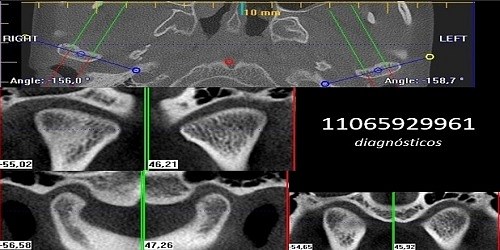 Odontología Neurofocal y Ortopedia Maxilar ATM