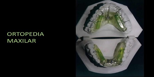 Odontología Neurofocal y Ortopedia Maxilar ATM