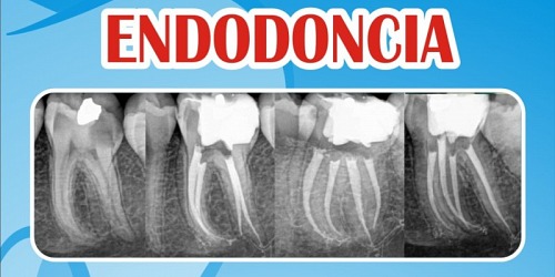 DentiLaser Odontología sin Dolor en Ecuador