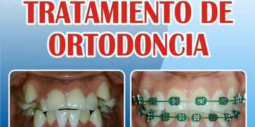 DentiLaser Odontología sin Dolor en Ecuador