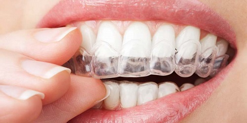 DentiLaser Odontología sin Dolor en Ecuador