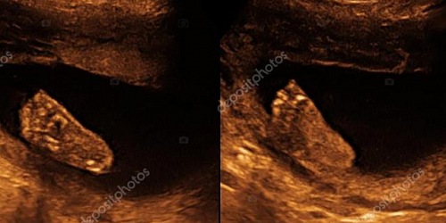 DRA. YADIRA JIMENEZ ARMENTA,ESPECIALISTA RADIOLOGIA E IMAGEN