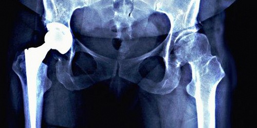 DRA. YADIRA JIMENEZ ARMENTA,ESPECIALISTA RADIOLOGIA E IMAGEN