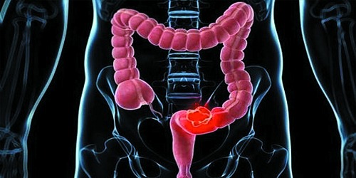 GASTROENTEROLOGO Y ENDOSCOPIA CANCUN DR. ALEJANDRO AGUIRRE