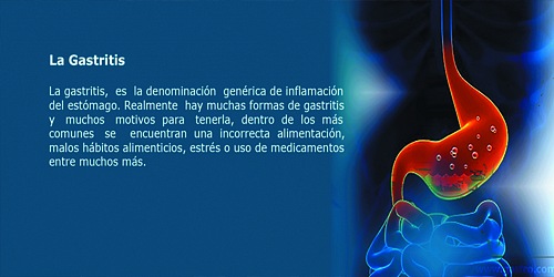 GASTROENTEROLOGO Y ENDOSCOPIA CANCUN DR. ALEJANDRO AGUIRRE