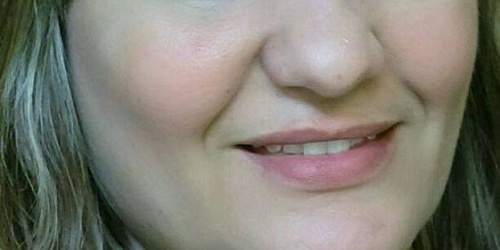 DENTAL KOH Mexicali